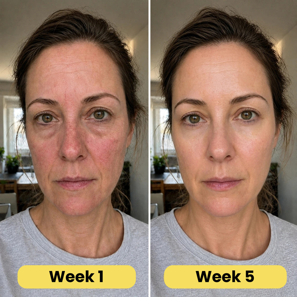 VoluFine | Korean Collagen Serum for Mature Skin
